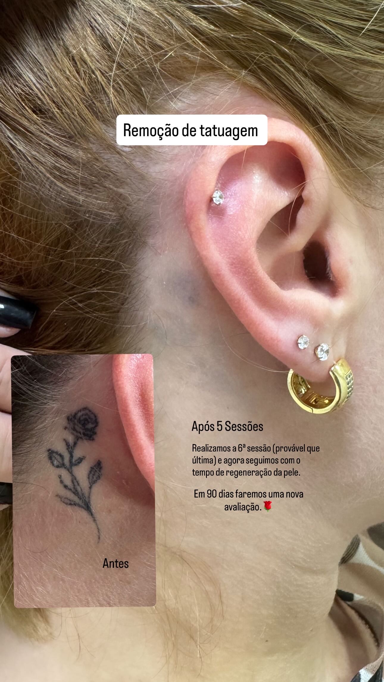 D03966B8-CAA9-4CF5-A225-064CD2360FDE