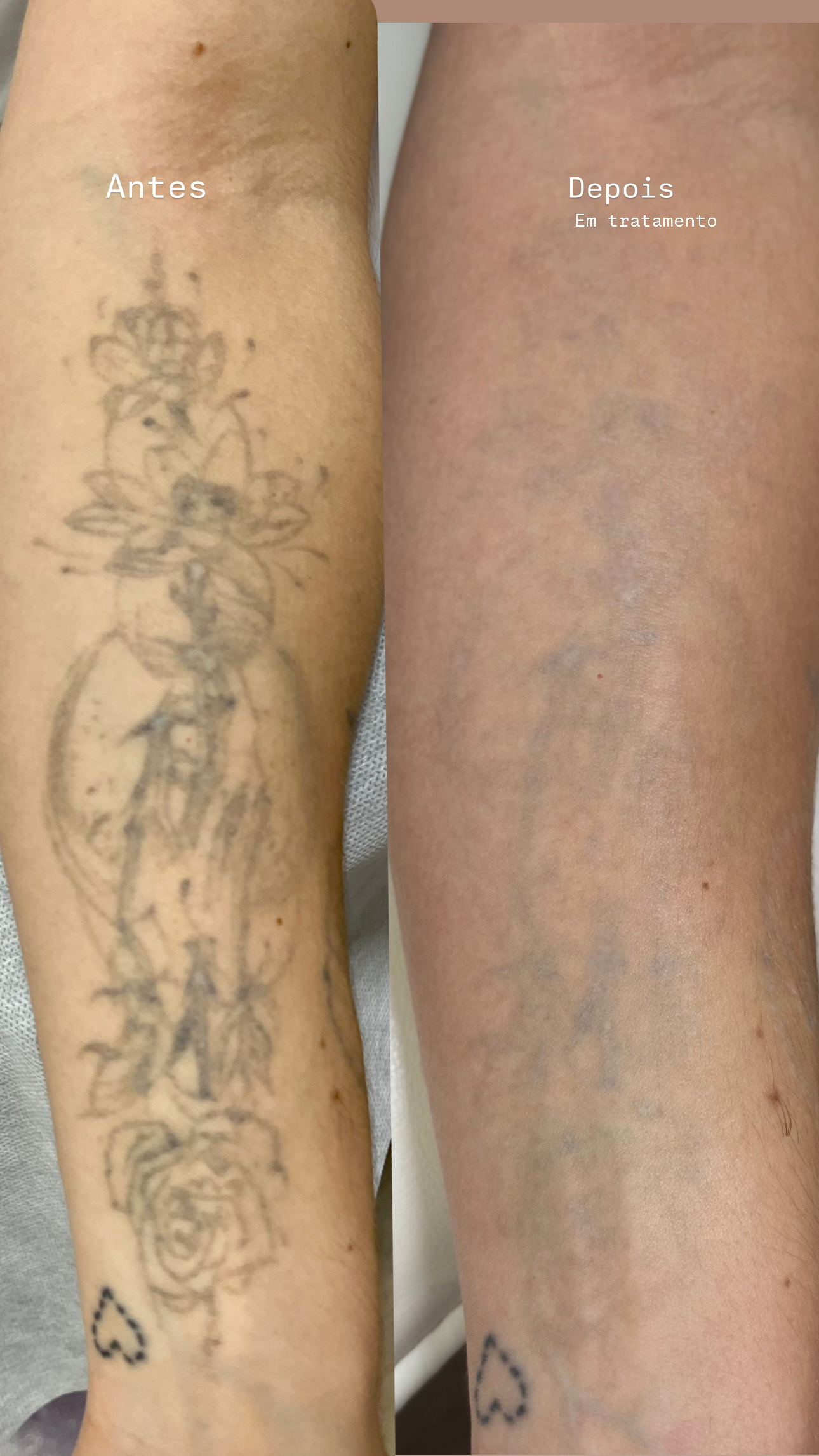 DB0C5986-9910-42B1-9594-517AB80A1022