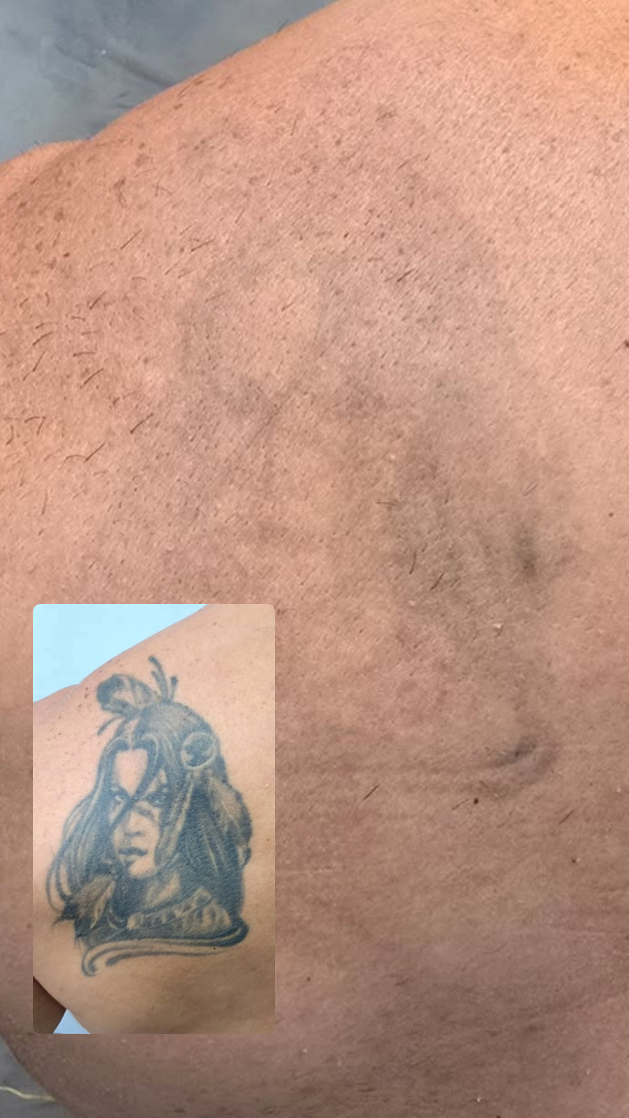 E40A991A-BEF3-47BC-A553-B02BC65CC0D1 1